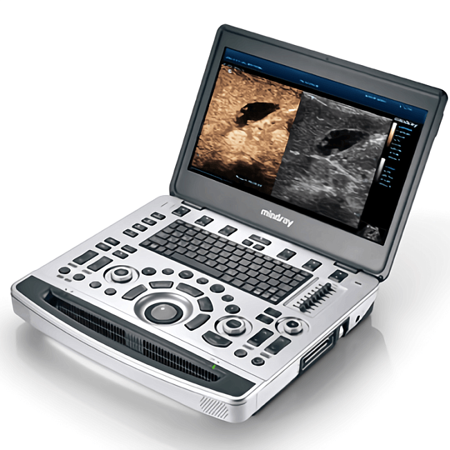 Ультразвуковой аппарат экспертного класса Mindray М9