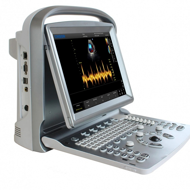 Ветеринарный аппарат УЗИ CHISON Eco 5 VET