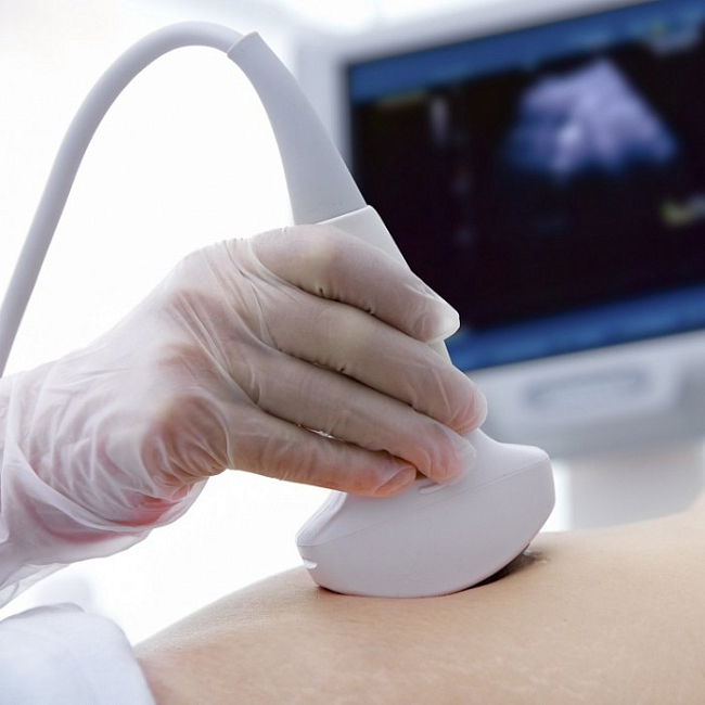 Аппарат ультразвукового сканирования Rimed DigiLite