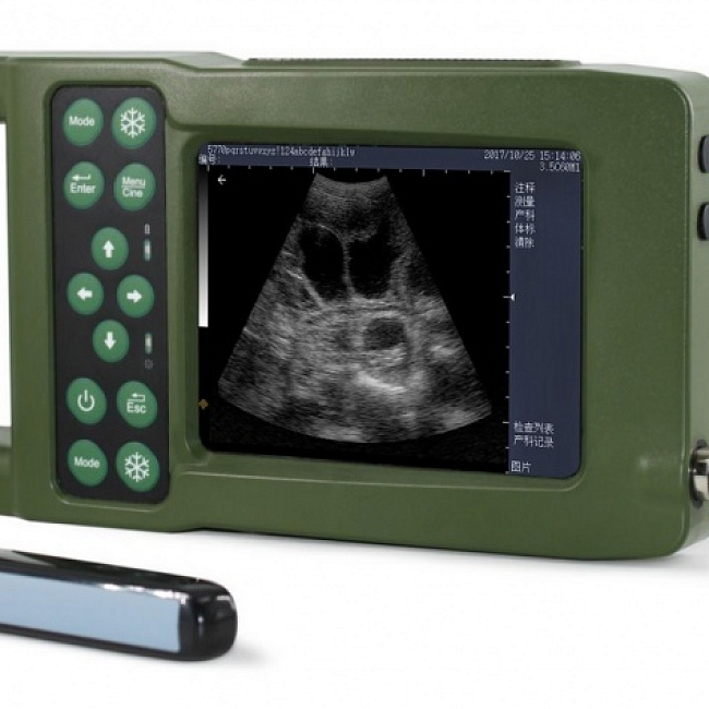 Портативный цифровой ультразвуковой диагностический аппарат KAIXIN V2