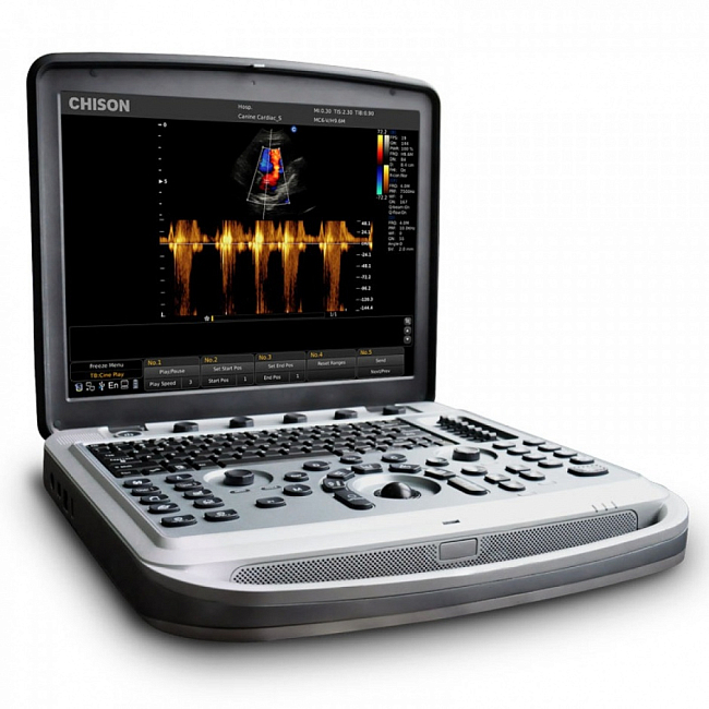 Ультразвуковой аппарат диагностический портативный CHISON Sonotouch 80